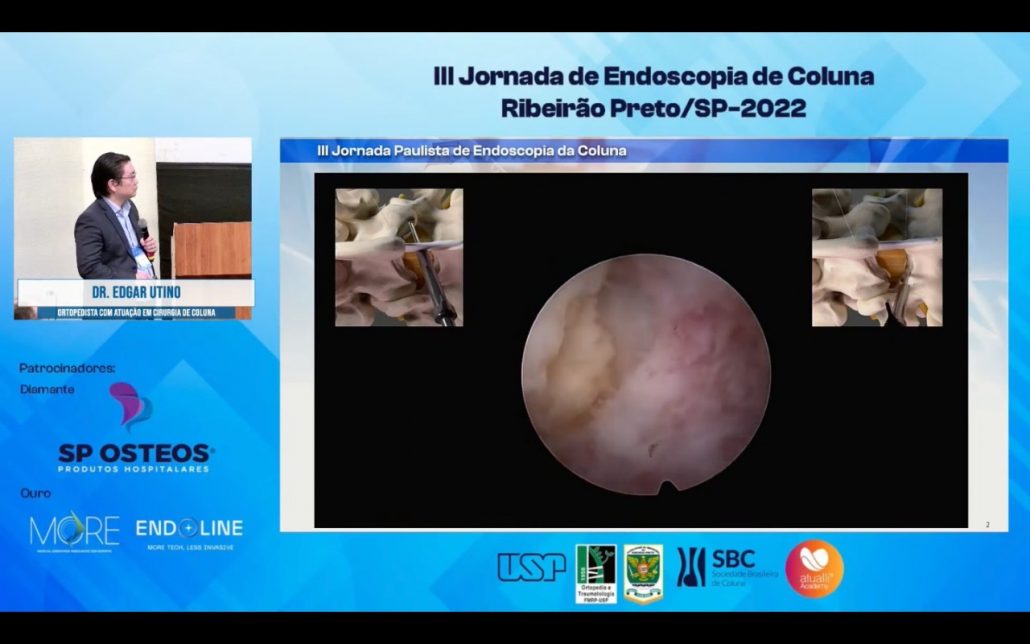 III Jornada Paulista de Endoscopia de Coluna